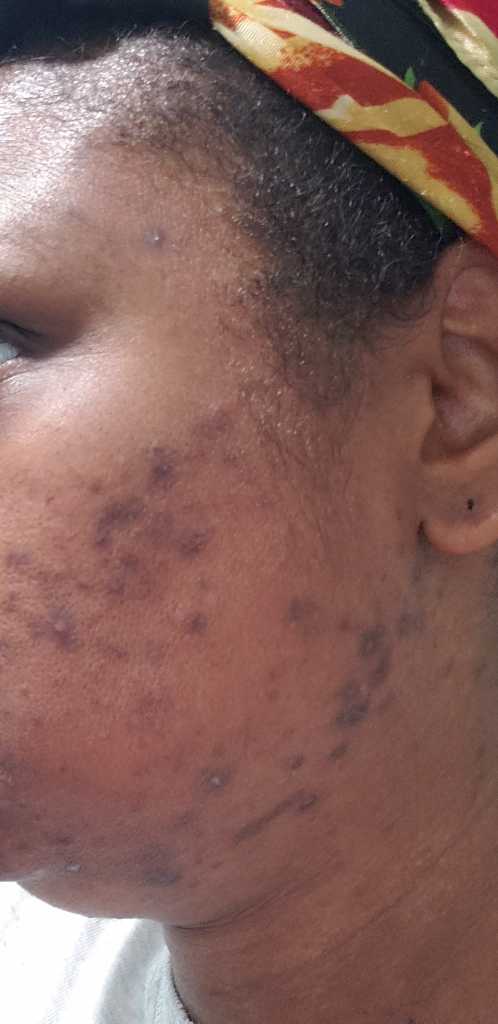 PURE SKIN FACE CLEANSER