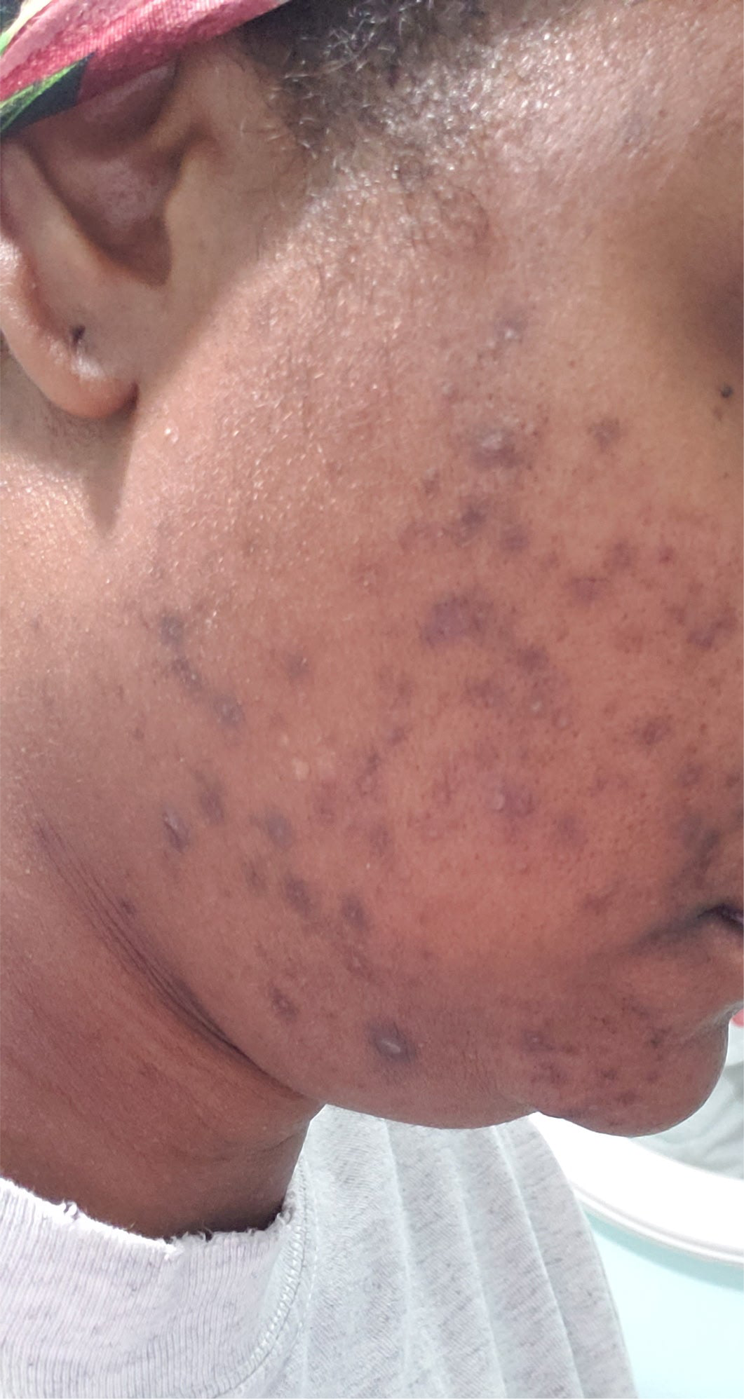 PURE SKIN FACE CLEANSER